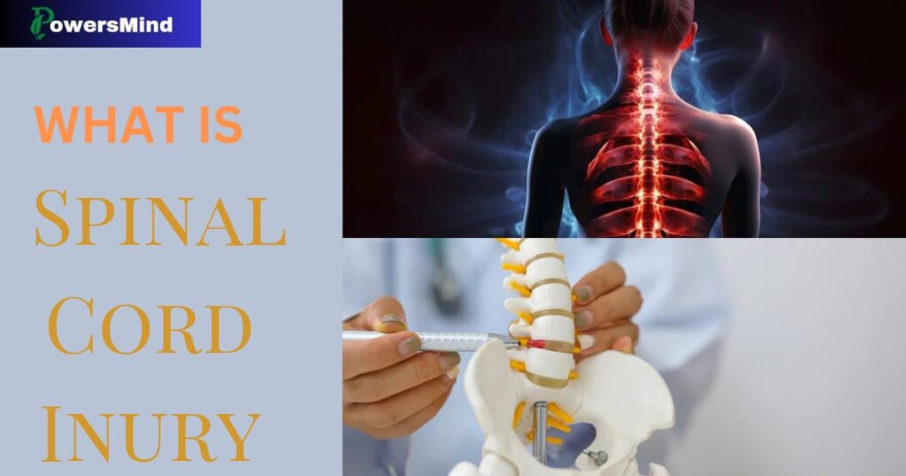 Spinal Cord Injury क्या है रीढ़ की हड्डी में चोट के लक्षण और समस्या आदी के बारे में डिटेल जानें:-