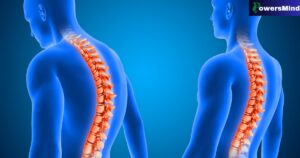 Spinal Cord Injury क्या होता है?