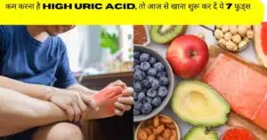 घर बैठे कम करना है अपनो High Uric Acid, तो बस आज से खाना शुरू कर दें ये 7 फूड्स