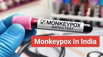 Monkeypox In India: भारत में मंकीपॉक्स का नया स्ट्रेन, जानें ये कितना खतरनाक, क्यों है जानलेवा और कैसे बचें?