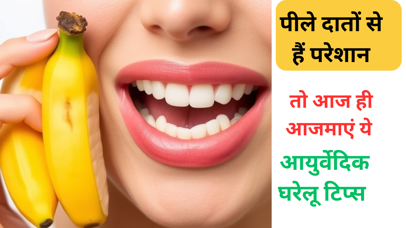 Banana Peel For White Teeth पीले दातों से हैं परेशान, तो केले के छिलके में मिलाएं ये चीज, हफ्ते में 2 बार लगाएं, चमकगें दांत