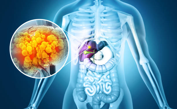 Liver Damage Signs In Urine: पेशाब में दिखने लगे ये 5 बड़ी बदलाव होते है लिवर डैमेज के लक्षण न करें इग्नोर