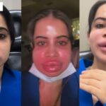 Urfi Javed Viral Video: कार्टून’ जैसी आखिर क्यों हो गई Urfi Javed की शक्ल, होठ मोटी ,सूजा चेहरा, बदला लुक देख फैंस रह गए हैरान!