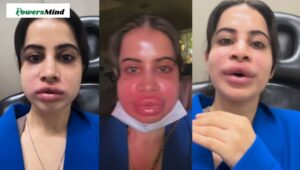 Urfi Javed Viral Video: कार्टून’ जैसी आखिर क्यों हो गई Urfi Javed की शक्ल, होठ मोटी ,सूजा चेहरा, बदला लुक देख फैंस रह गए हैरान!