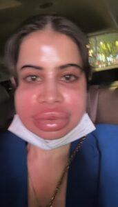 Urfi Javed Viral Video: कार्टून’ जैसी आखिर क्यों हो गई Urfi Javed की शक्ल, होठ मोटी ,सूजा चेहरा, बदला लुक देख फैंस रह गए हैरान!